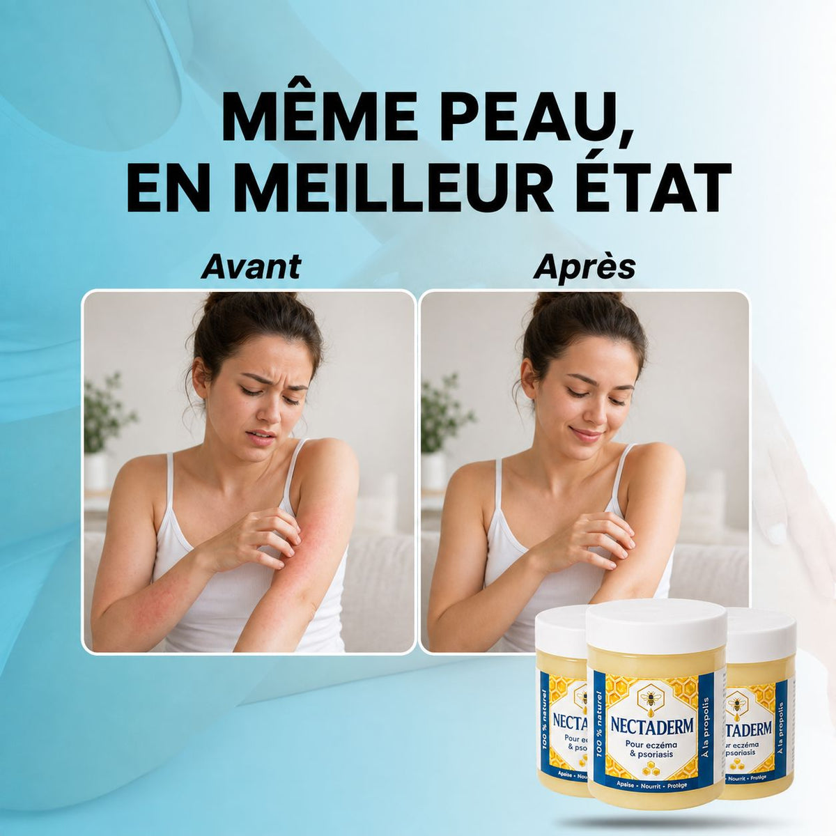 Nectaderm - Baume Réparateur Eczéma & Psoriasis