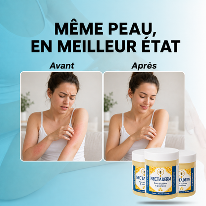 Nectaderm - Baume Réparateur Eczéma & Psoriasis