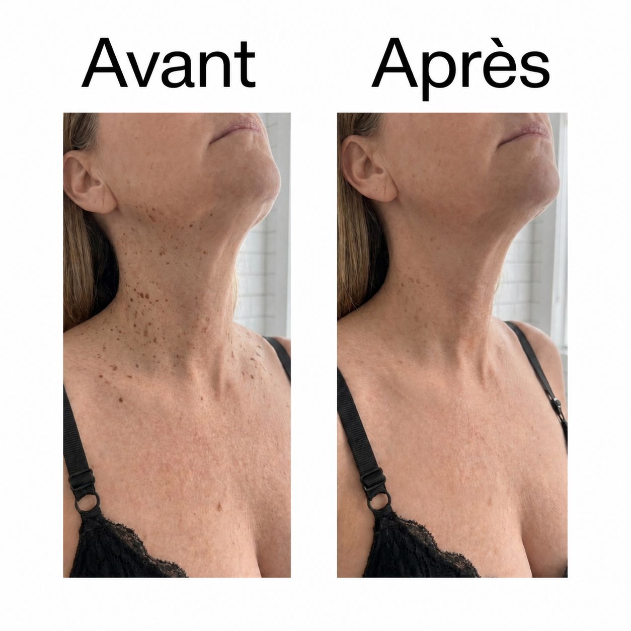 DERMALIS — Stick Lissant & Exfoliant à l’Acide Glycolique