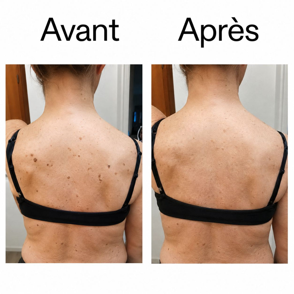 DERMALIS — Stick Lissant & Exfoliant à l’Acide Glycolique