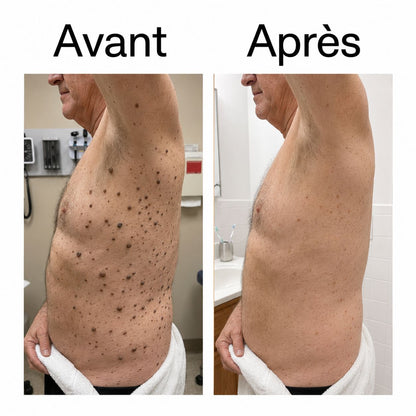 DERMALIS — Le Stick Lissant & Exfoliant à l’Acide Glycolique