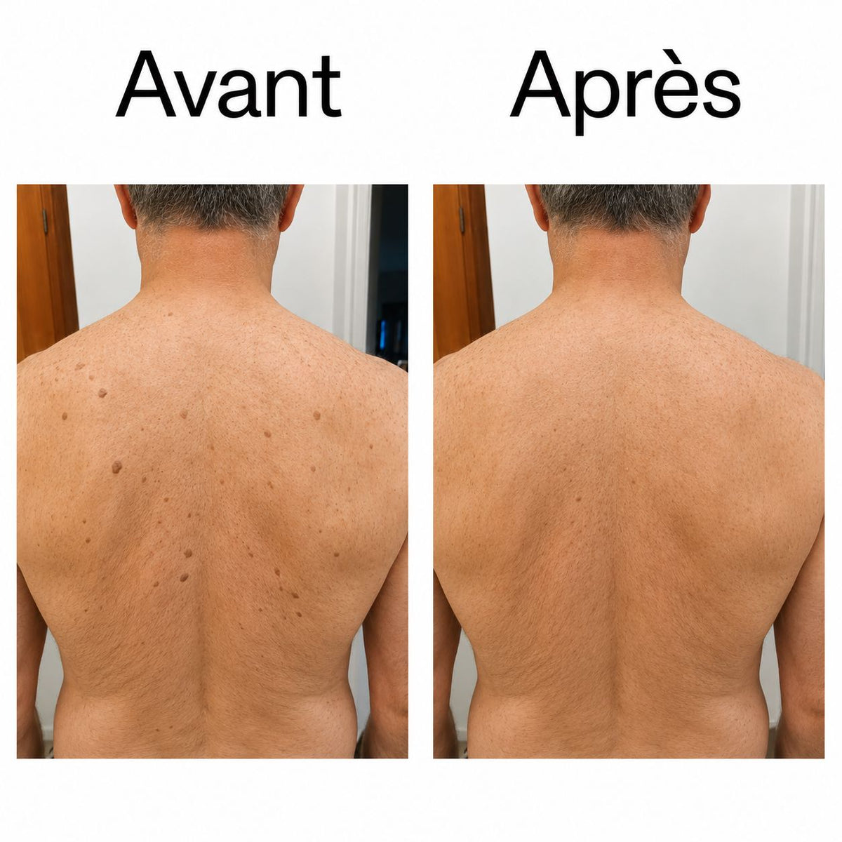 DERMALIS — Le Stick Lissant & Exfoliant à l’Acide Glycolique