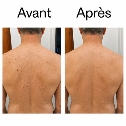 DERMALIS — Le Stick Lissant & Exfoliant à l’Acide Glycolique
