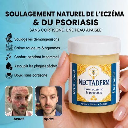 Nectaderm - Baume Réparateur Eczéma & Psoriasis